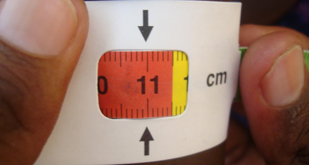 Social Capital and Malnutrition: A Case Study in Peru