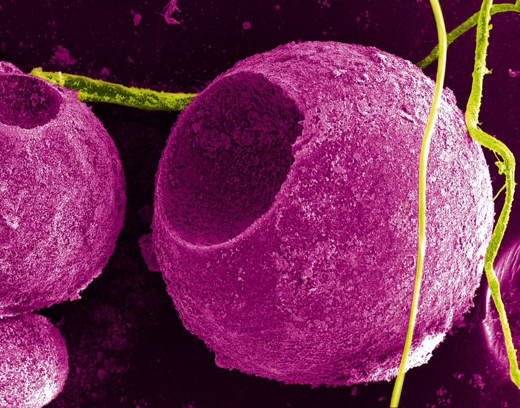 Better Outcomes, Lower Costs?